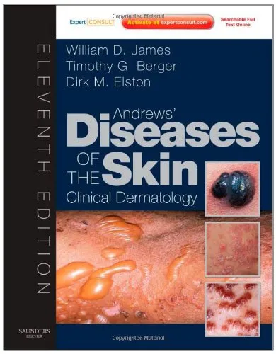 Andrews' Diseases of the Skin: Clinical Dermatology - Expert Consult - Online and Print (James, Andrew's Disease of the Skin), 11th Edition