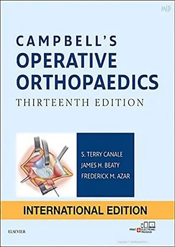 CAMPBELL’S OPERATIVE ORTHOPAEDICS