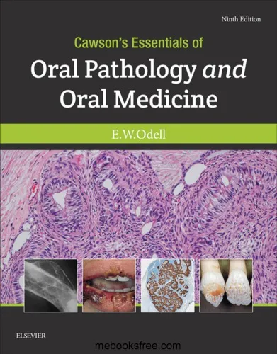 Cawson’s Essentials of Oral Pathology and Oral Medicine