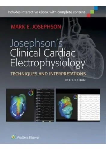 Clinical Cardiac Electrophysiology Techniques and Interpretations