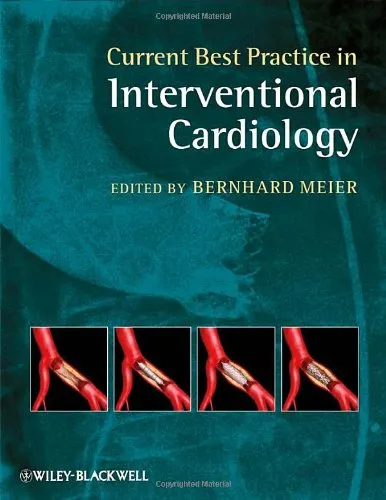 Current Best Practice in Interventional Cardiology