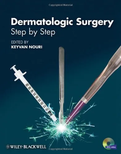 Dermatologic Surgery: Step by Step