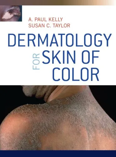 Dermatology for Skin of Color