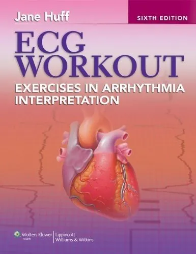 ECG Workout: Exercises in Arrhythmia Interpretation