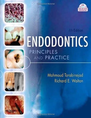 Endodontics: Principles and Practice, 4e