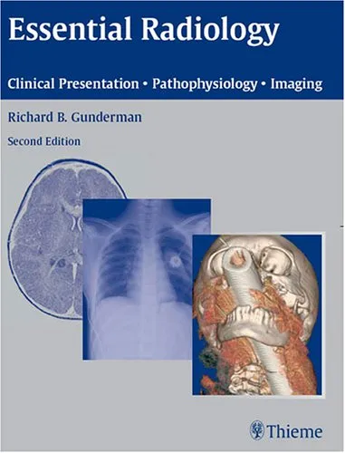 Essential Radiology: Clinical Presentation  Pathophysiology  Imaging