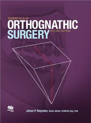 Essentials of Orthognathic Surgery