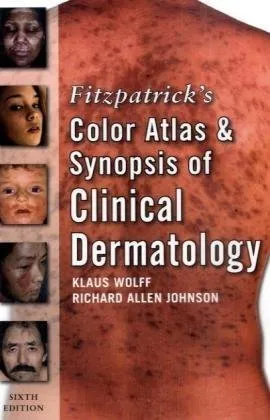Fitzpatrick's Color Atlas and Synopsis of Clinical Dermatology: Sixth Edition