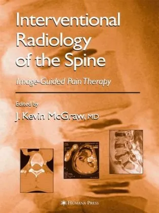Interventional Radiology in Pain Treatment