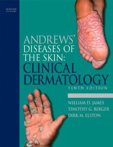 James, Andrew's Disease of the Skin