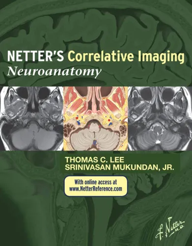 Netter’s Correlative Imaging: Neuroanatomy: with NetterReference.com Access, 1e