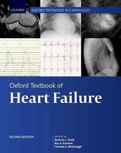 Oxford Textbook of Heart Failure (Oxford Textbooks in Cardiology) [Team-IRA] (True PDF_