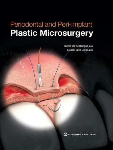 Cover of Periodontal and Peri-implant Plastic Microsurgery: Minimally Invasive Techniques with Maximum Precision