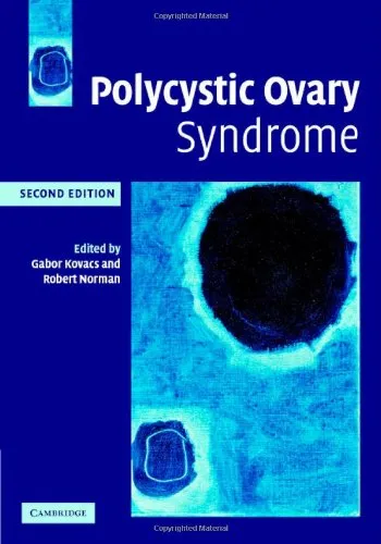 Polycystic Ovary Syndrome; 2nd edition