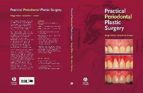 Practical Periodontal Plastic Surgery