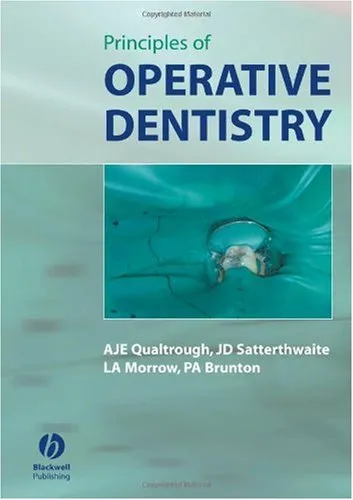 Principles of Operative Dentistry