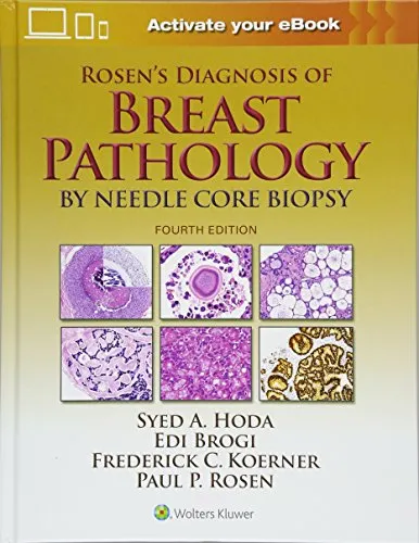 Rosen’s Diagnosis of Breast Pathology by Needle Core Biopsy