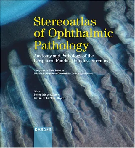 Stereoatlas of Ophthalmic Pathology: Anatomy and Pathology of the Peripheral Fundus ( Fundus extremus)