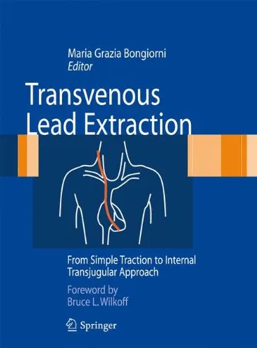 Transvenous Lead Extraction: From Simple Traction to Internal Transjugular Approach